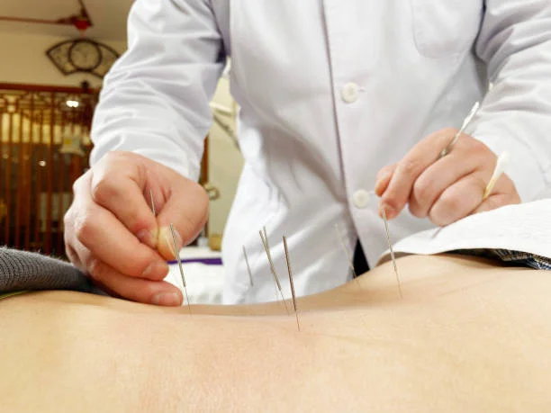 Acupuncture and Fertility: How can Acupuncture help with Fertility